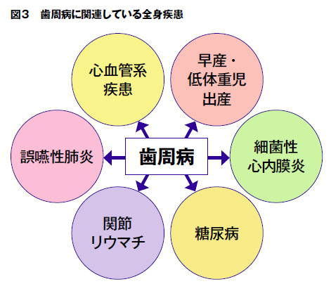 歯周病に関連している全身疾患